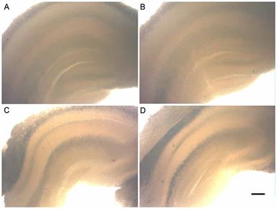 Neuroprotective Effects of Kinin B2 Receptor in Organotypic Hippocampal Cultures of Middle-Aged Mice